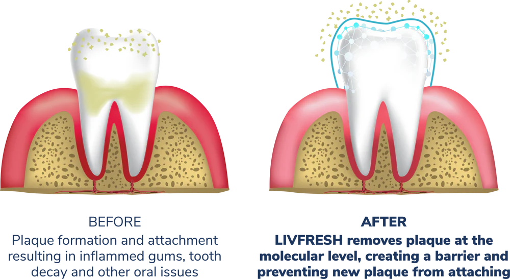 LivFresh Gel Toothpaste